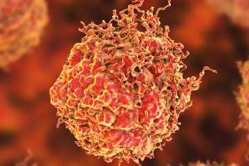 前列腺癌细胞